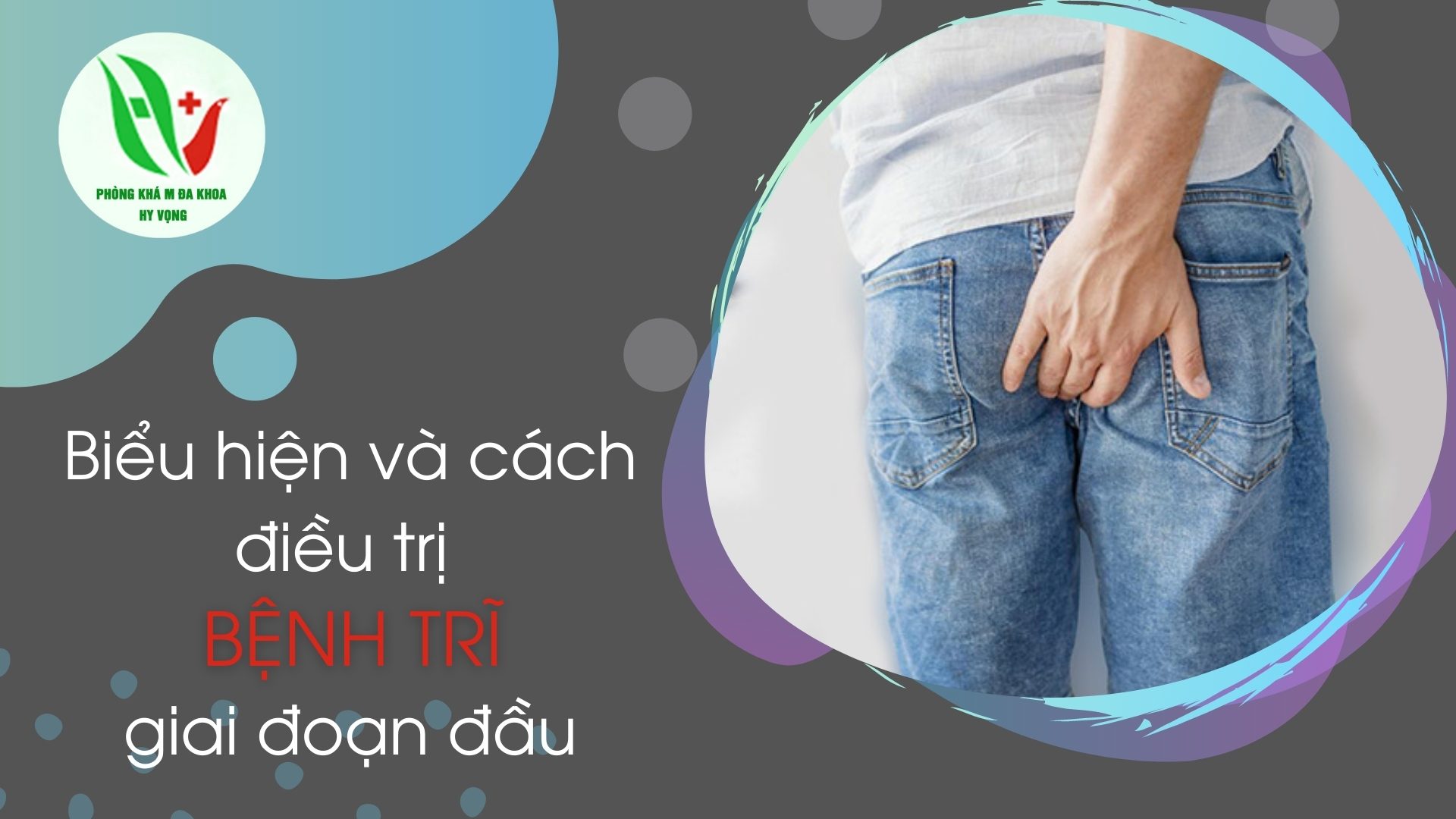 Biểu hiện và cách điều trị bệnh trĩ giai đoạn đầu